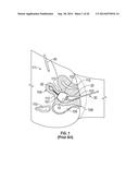 UTERINE MANIPULATOR diagram and image