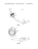 UTERINE MANIPULATOR diagram and image