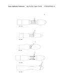 UTERINE MANIPULATOR diagram and image