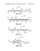 RECANALIZATION DEVICE diagram and image