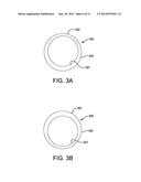 RECANALIZATION DEVICE diagram and image