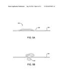 RECANALIZATION DEVICE diagram and image