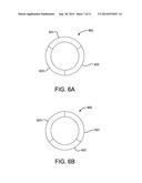 RECANALIZATION DEVICE diagram and image