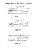 RECANALIZATION DEVICE diagram and image