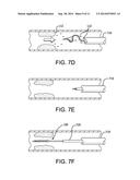 RECANALIZATION DEVICE diagram and image