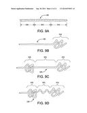 RECANALIZATION DEVICE diagram and image