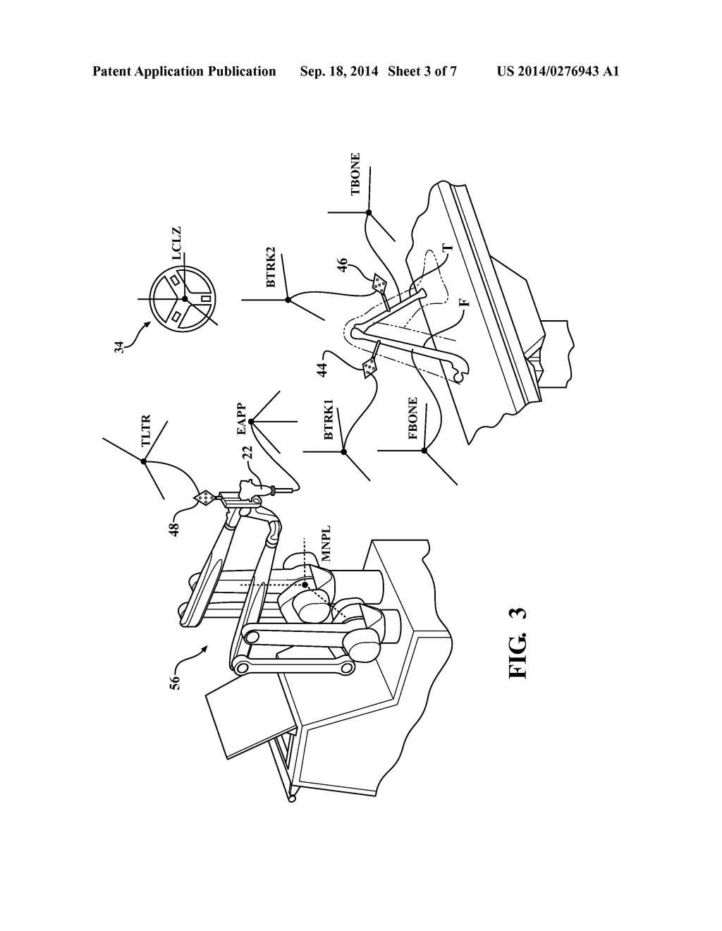 Systems and Methods for Establishing Virtual Constraint Boundaries - diagram, schematic, and image 04