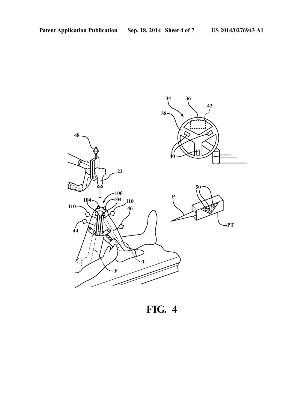 Systems and Methods for Establishing Virtual Constraint Boundaries - diagram, schematic, and image 05