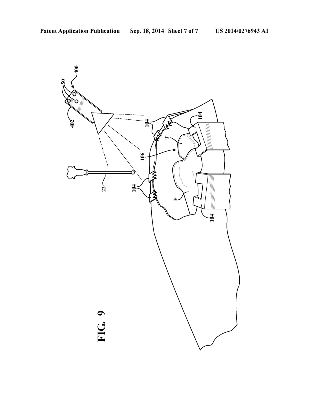 Systems and Methods for Establishing Virtual Constraint Boundaries - diagram, schematic, and image 08