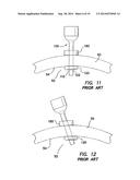 TROCAR CANNULA ASSEMBLY WITH LOW PROFILE  INSERTION CONFIGURATION AND     METHOD OF MANUFACTURE diagram and image