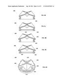 Sealing Multiple Surgical Instruments diagram and image