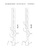 HANDLING OF FASTENERS WITHIN A SURGICAL INSTRUMENT diagram and image