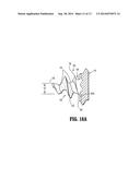 Surgical Instrument For Dispensing Tacks And Solution diagram and image