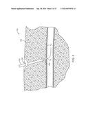 Suturing Device and Method for Sealing an Opening in a Blood Vessel or     Other Biological Structure diagram and image