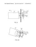 Suturing Device and Method for Sealing an Opening in a Blood Vessel or     Other Biological Structure diagram and image