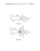 Suturing Device and Method for Sealing an Opening in a Blood Vessel or     Other Biological Structure diagram and image