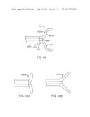 Suturing Device and Method for Sealing an Opening in a Blood Vessel or     Other Biological Structure diagram and image