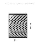 IMPLANTABLE SILK PROSTHETIC DEVICE AND USES THEREOF diagram and image