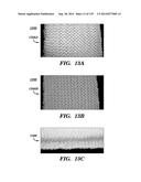 IMPLANTABLE SILK PROSTHETIC DEVICE AND USES THEREOF diagram and image