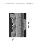 IMPLANTABLE SILK PROSTHETIC DEVICE AND USES THEREOF diagram and image