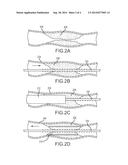 Material Capturing Guidewire diagram and image