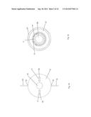 Device and Method for Treating a Chronic Total Occlusion diagram and image