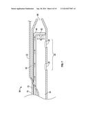 HYDRODYNAMIC ECCENTRICALLY PIVOTING CATHETER diagram and image