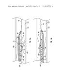 HYDRODYNAMIC ECCENTRICALLY PIVOTING CATHETER diagram and image