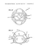 Multi-Component Obstruction Removal System And Method diagram and image