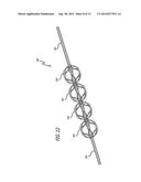 Multi-Component Obstruction Removal System And Method diagram and image