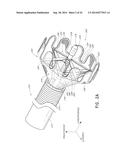 VASCULAR PLAQUE REMOVAL SYSTEMS, DEVICES, AND METHODS diagram and image