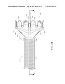 VASCULAR PLAQUE REMOVAL SYSTEMS, DEVICES, AND METHODS diagram and image