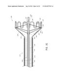 VASCULAR PLAQUE REMOVAL SYSTEMS, DEVICES, AND METHODS diagram and image