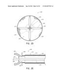 VASCULAR PLAQUE REMOVAL SYSTEMS, DEVICES, AND METHODS diagram and image