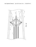 VASCULAR PLAQUE REMOVAL SYSTEMS, DEVICES, AND METHODS diagram and image