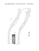 VASCULAR PLAQUE REMOVAL SYSTEMS, DEVICES, AND METHODS diagram and image