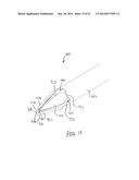 TYMPANOSTOMY TUBE DELIVERY DEVICE WITH CUTTING DILATOR diagram and image