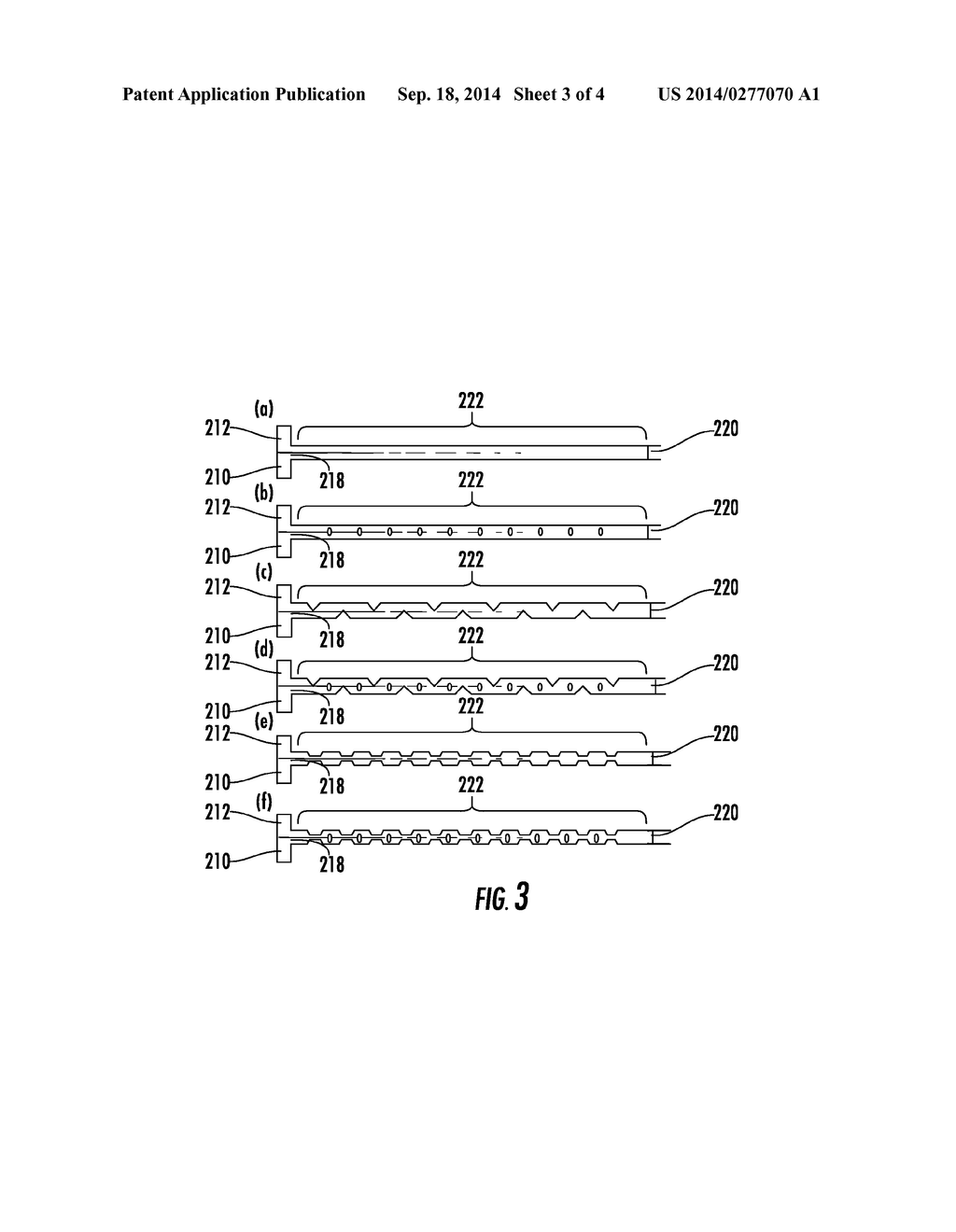 METHODS, COMPOSITIONS, AND DEVICES FOR THE OCCLUSION OF CAVITIES AND     PASSAGEWAYS - diagram, schematic, and image 04