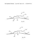 QUICK-CONNECT BUCKLE FOR A TOURNIQUET AND METHODS ASSOCIATED THEREWITH diagram and image