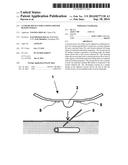 CLOSURE DEVICE FOR CLOSING OPENED BLOOD VESSELS diagram and image