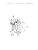 PEDICLE-BASED CONSTRUCT FACET JOINT FIXATION DEVICE diagram and image