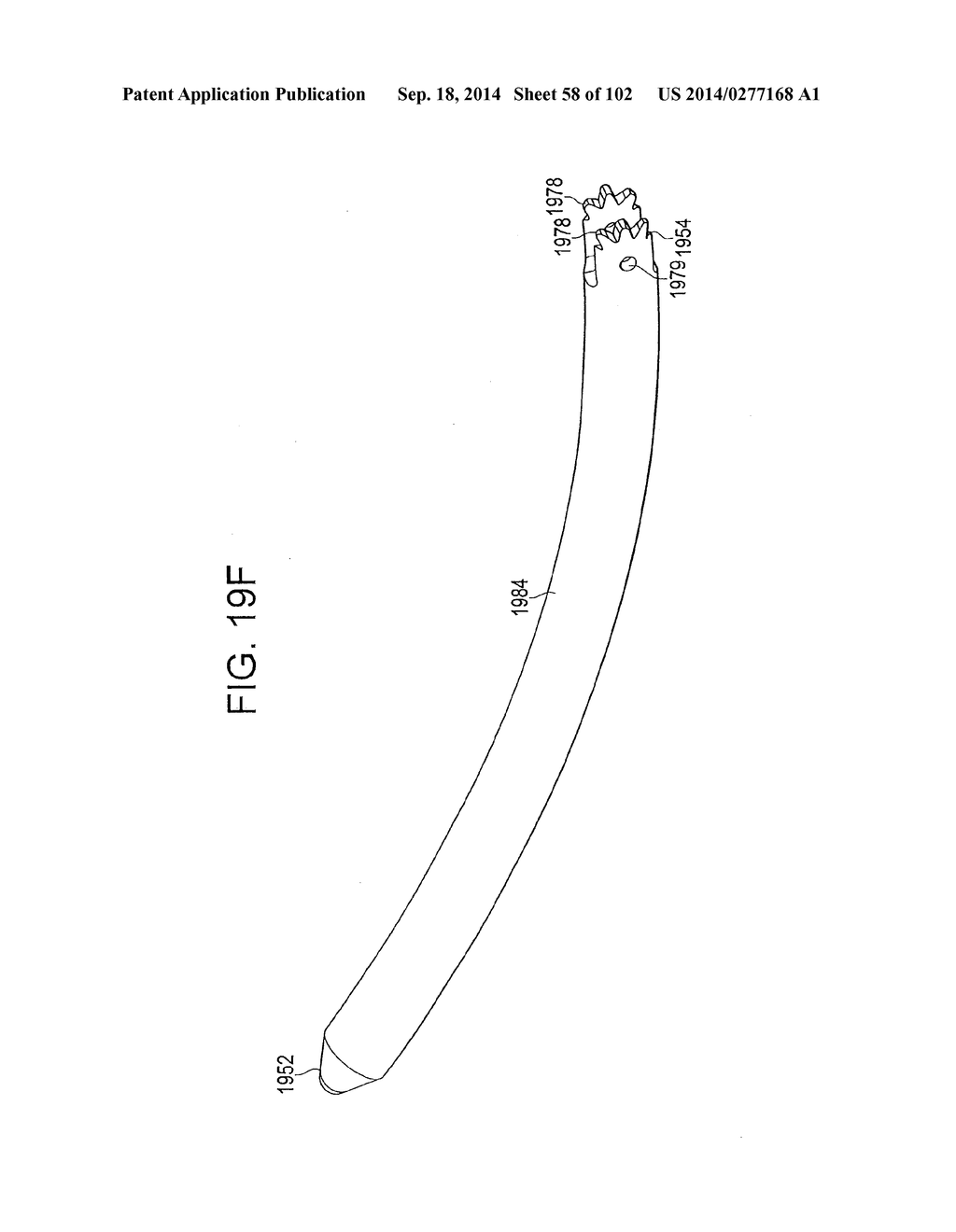 ROD INSERTER AND METHODS OF USE - diagram, schematic, and image 59