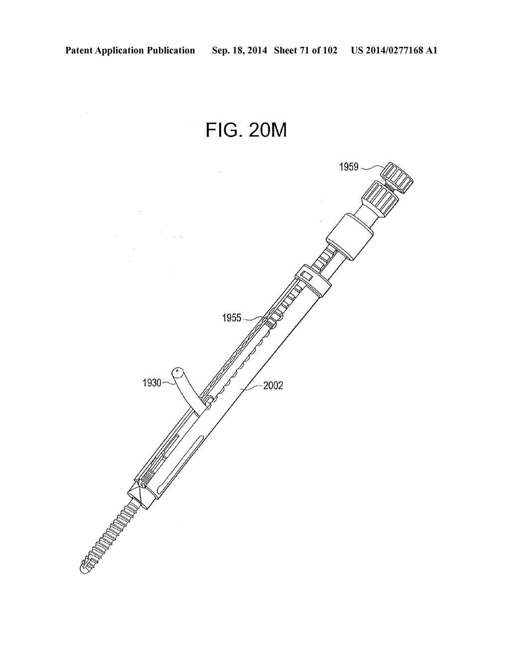 ROD INSERTER AND METHODS OF USE - diagram, schematic, and image 72