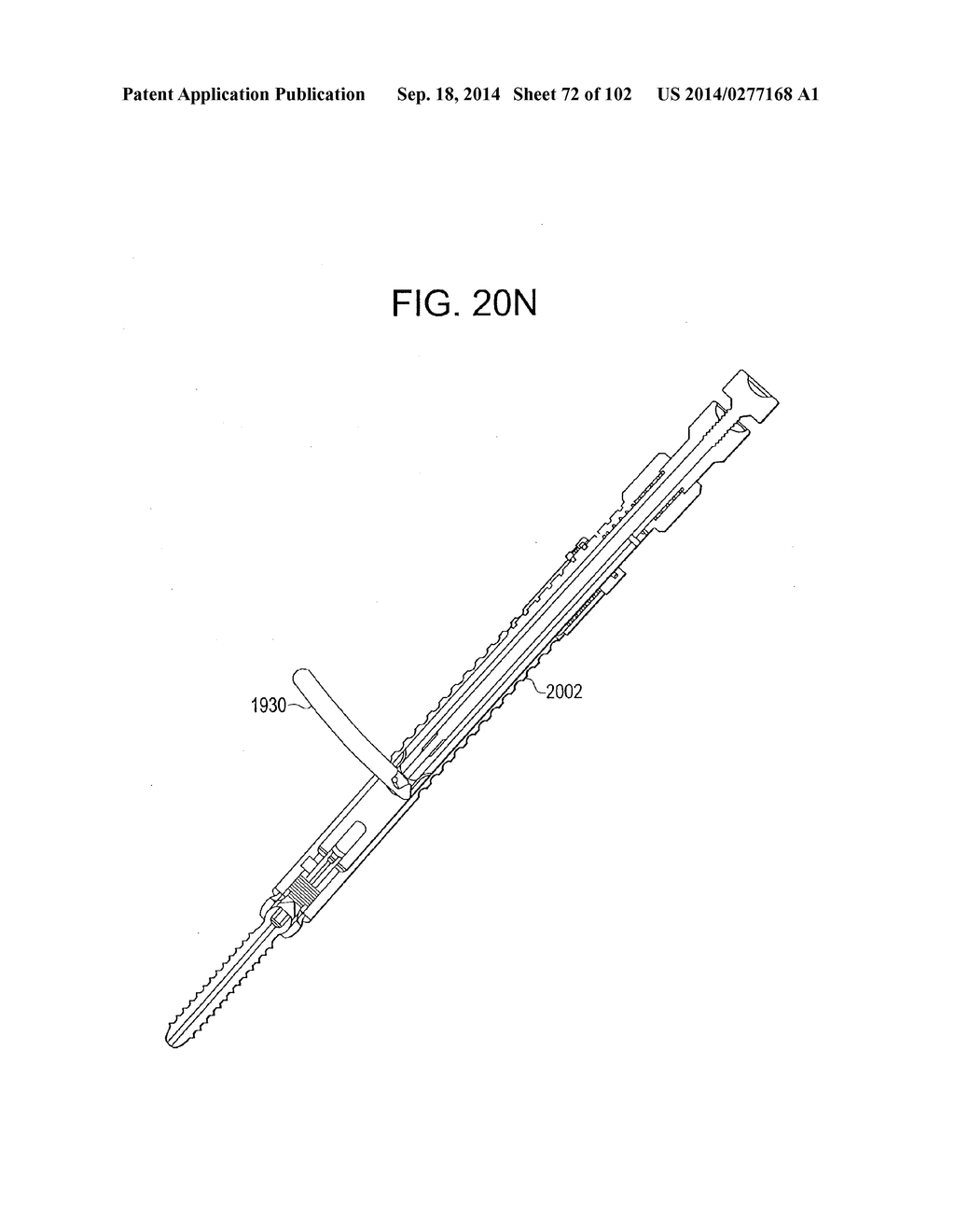 ROD INSERTER AND METHODS OF USE - diagram, schematic, and image 73