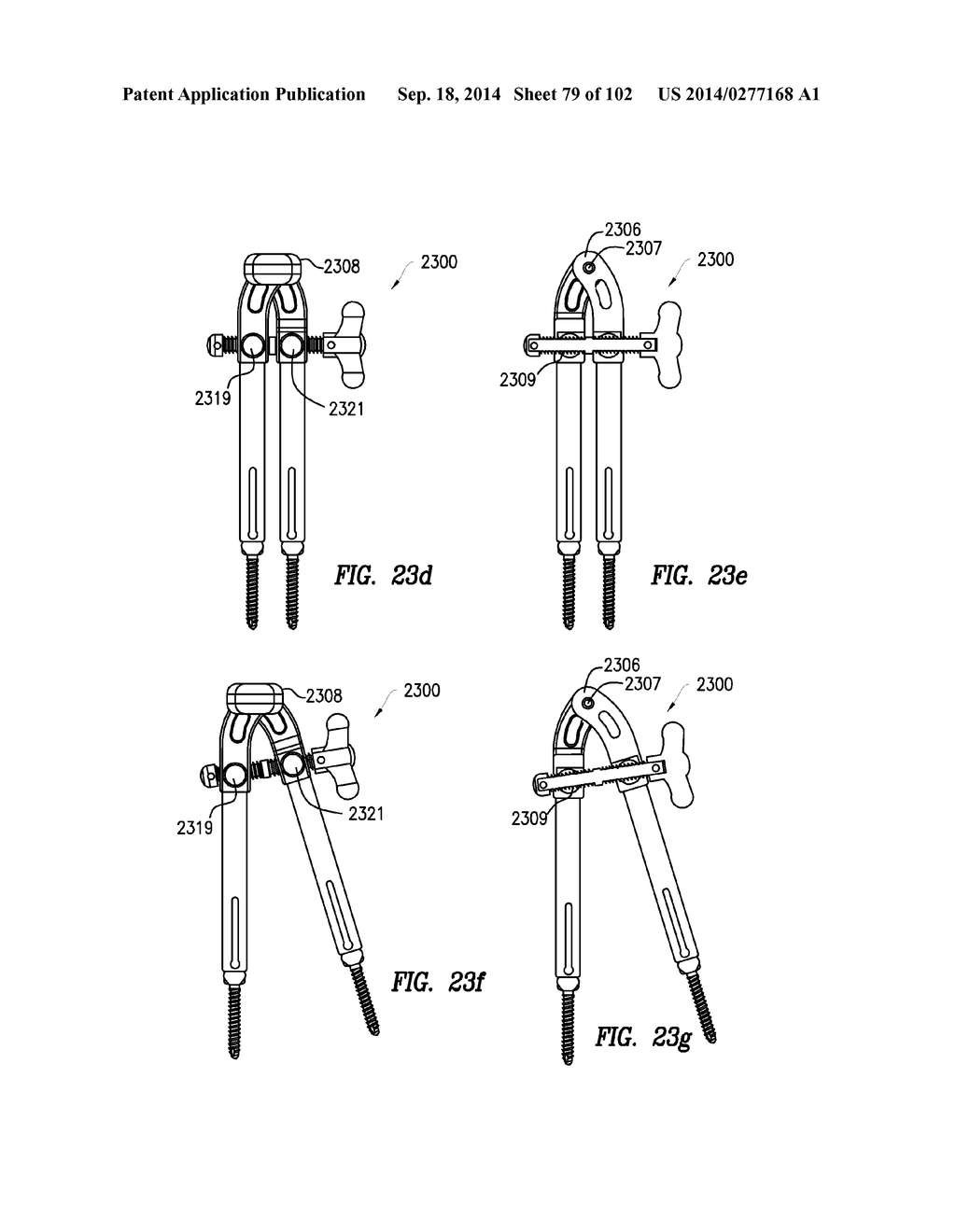 ROD INSERTER AND METHODS OF USE - diagram, schematic, and image 80