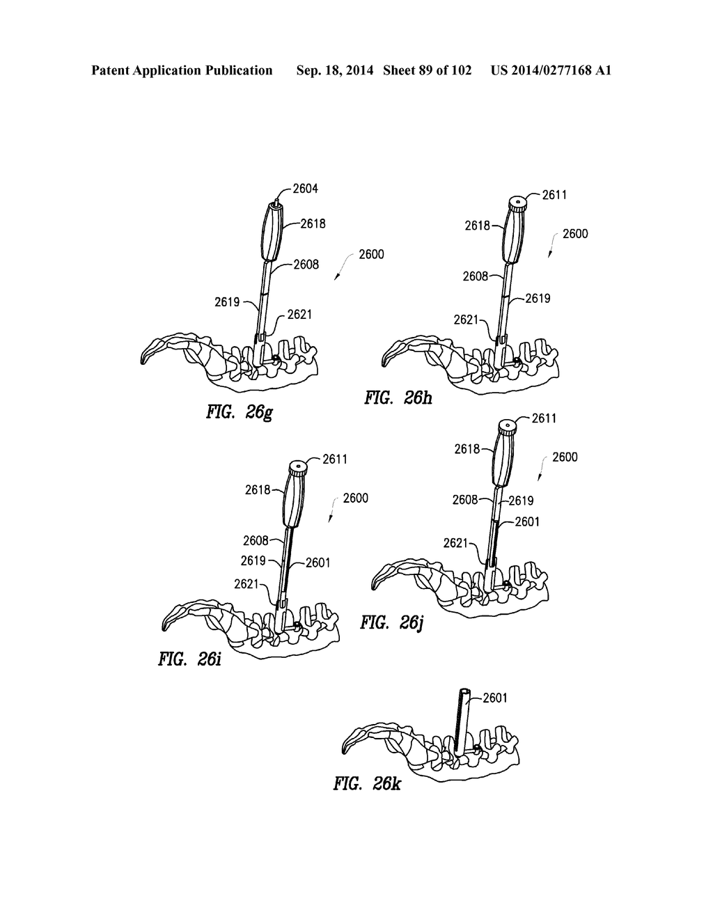 ROD INSERTER AND METHODS OF USE - diagram, schematic, and image 90