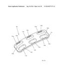 Anterior Cervical Instrumentation Systems, Methods And Devices diagram and image