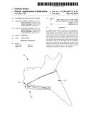 MANDIBULAR BONE PLATE SYSTEMS diagram and image