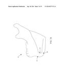 MANDIBULAR BONE PLATE SYSTEMS diagram and image