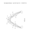 MANDIBULAR BONE PLATE SYSTEMS diagram and image